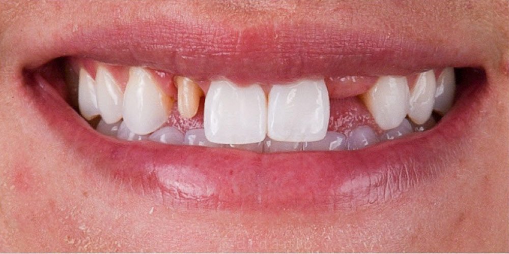 cosmetic-dentist-los-angeles-16-e1718263257472 (1)